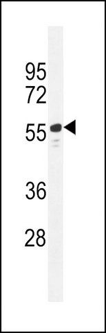 ANTI-TTC6 (C-TERM) antibody produced in rabbit