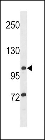 ANTI-TTLL8 (N-TERM) antibody produced in rabbit