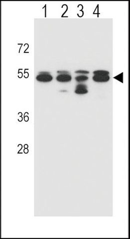 ANTI-TUBB8 (N-TERM) antibody produced in rabbit