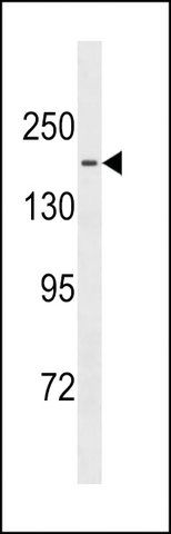 ANTI-TTBK1 (CENTER) antibody produced in rabbit