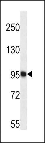 ANTI-TTC15(C-TERMINAL) antibody produced in rabbit