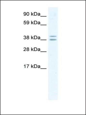 Anti-TSG101 (AB3) antibody produced in rabbit