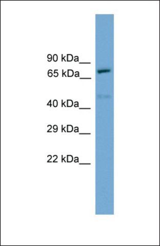 Anti-TRP73, (N-terminal) antibody produced in rabbit