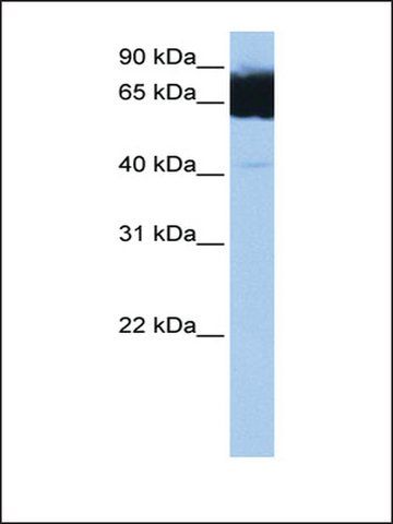 Anti-TTC12 antibody produced in rabbit