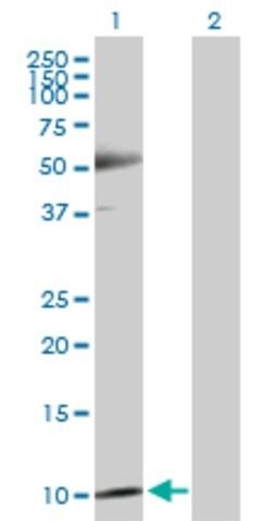 Anti-TXN antibody produced in rabbit