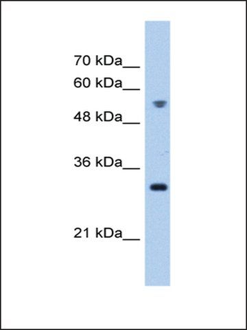 Anti-TTC5 antibody produced in rabbit