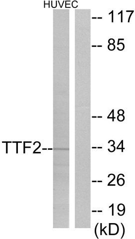 Anti-TTF2 antibody produced in rabbit