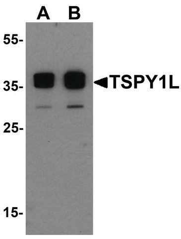 Anti-TSPY1L antibody produced in rabbit