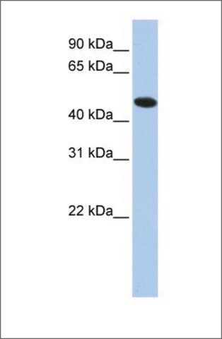 Anti-TXNDC5 antibody produced in rabbit