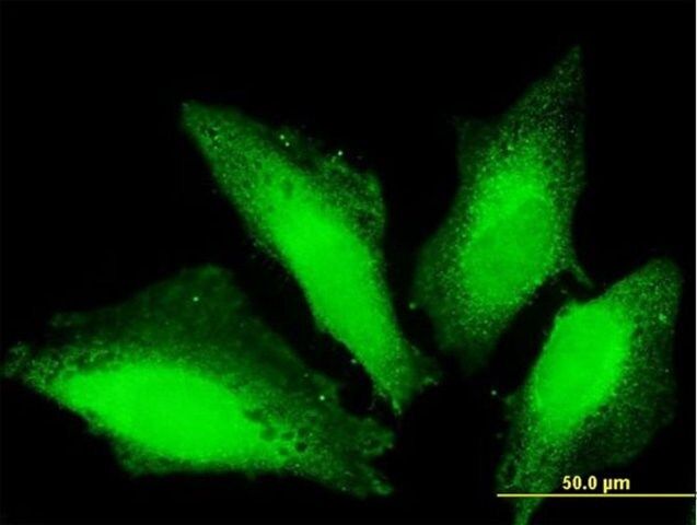 Anti-TTC15 antibody produced in mouse