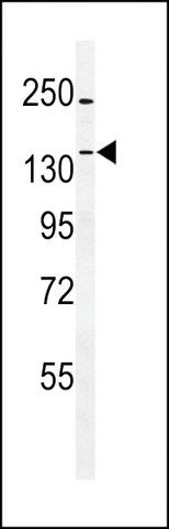 ANTI-TTBK1(N-TERMINAL) antibody produced in rabbit