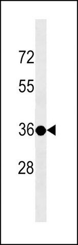 ANTI-TSPY3 (C-TERM) antibody produced in rabbit