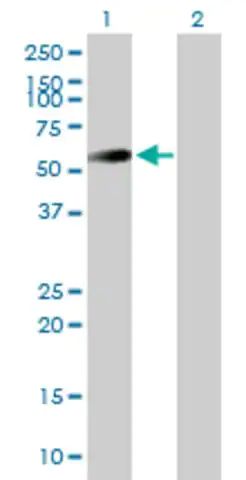 Anti-UAP1 antibody produced in mouse