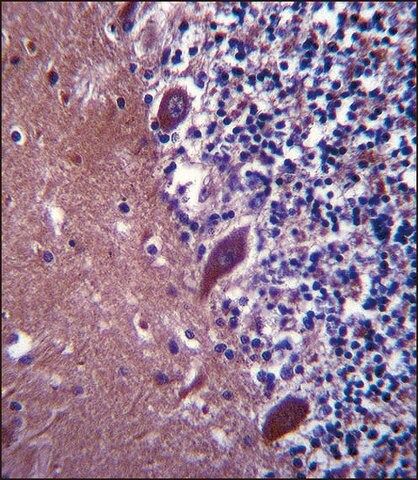 ANTI-TTC13 (N-TERM) antibody produced in rabbit