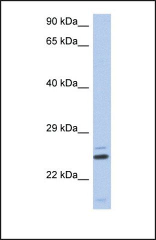 Anti-TTC9C, (N-terminal) antibody produced in rabbit