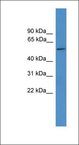 Anti-TTYH3 antibody produced in rabbit