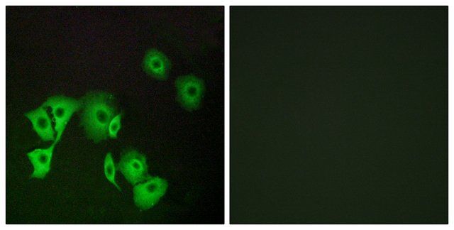 Anti-TTF2 antibody produced in rabbit