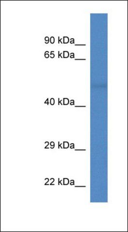 Anti-TUBA8 antibody produced in rabbit