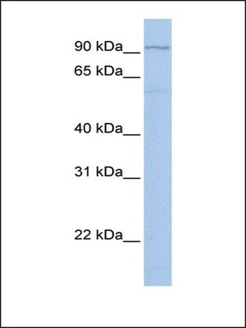 Anti-TTC16 antibody produced in rabbit