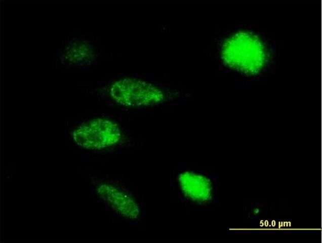 Anti-TUSC4 antibody produced in mouse