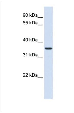 Anti-TXNDC14 antibody produced in rabbit