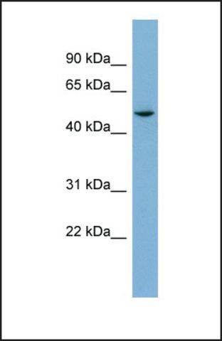 Anti-TUBE1 antibody produced in rabbit