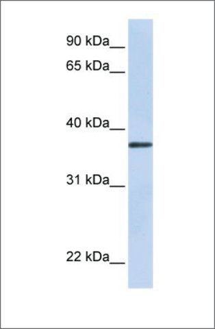 Anti-TTMB antibody produced in rabbit