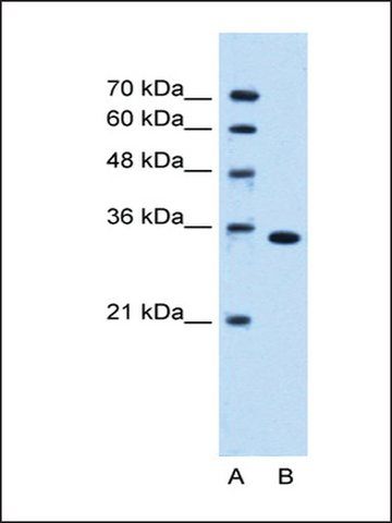 Anti-TYMS antibody produced in rabbit