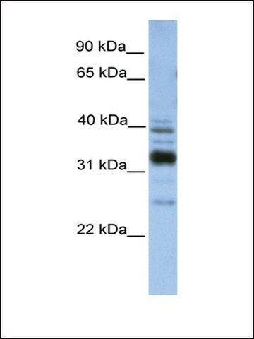 Anti-TXNDC13 antibody produced in rabbit