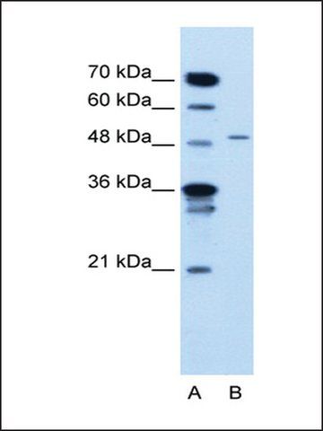 Anti-TYRP1 antibody produced in rabbit