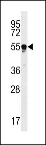 ANTI-TUBB4Q (N-TERM) antibody produced in rabbit