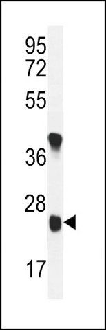 ANTI-U119B (C-TERM) antibody produced in rabbit