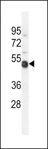 ANTI-TXNDC6 (CENTER) antibody produced in rabbit