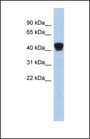 Anti-TXNDC4 antibody produced in rabbit