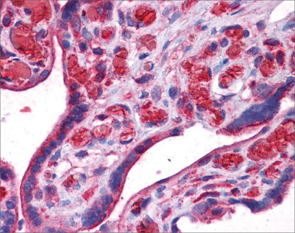 Anti-UCHL3, (N-terminal) antibody produced in rabbit