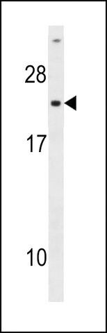 ANTI-UCK(C-TERMINAL) antibody produced in rabbit