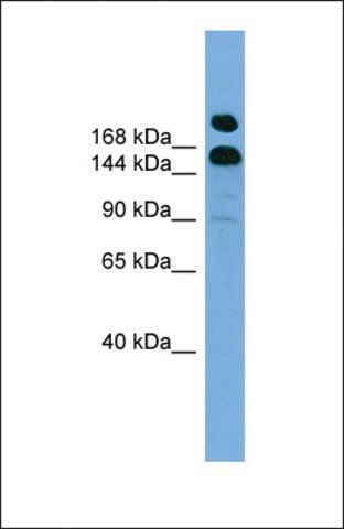 Anti-UGCGL1 antibody produced in rabbit