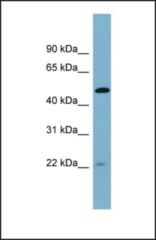 Anti-UCHL5IP antibody produced in rabbit