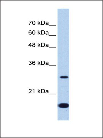 Anti-USE1 (AB1) antibody produced in rabbit