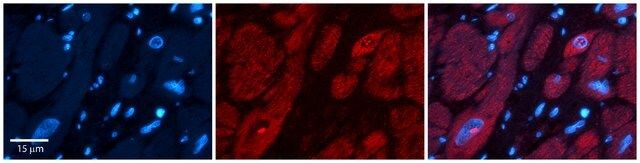 Anti-UPF1 antibody produced in rabbit