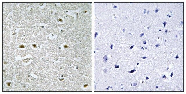 Anti-URB1 antibody produced in rabbit