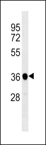 ANTI-XENLA PPP1CB(C-TERMINAL) antibody produced in rabbit