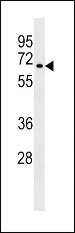 ANTI-YF005(N-TERMINAL) antibody produced in rabbit