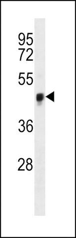 ANTI-YAP (CENTER S127) antibody produced in rabbit