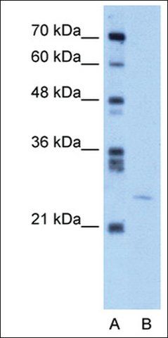 Anti-YEATS4 antibody produced in rabbit