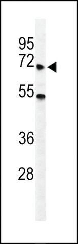 ANTI-YTHD3 (CENTER) antibody produced in rabbit