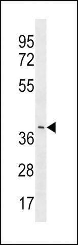 ANTI-YV012(C-TERMINAL) antibody produced in rabbit