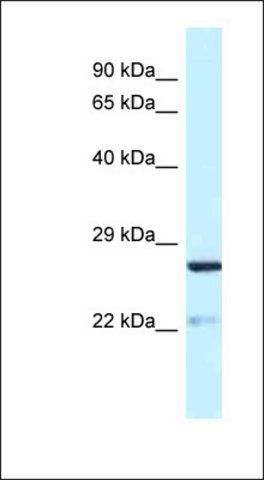 Anti-YIPF5 antibody produced in rabbit