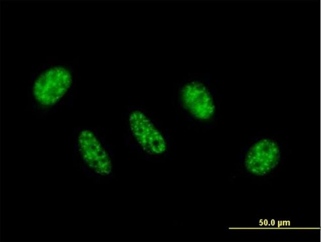 Anti-ZC3H11A antibody produced in mouse