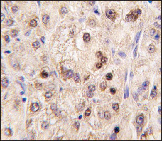 Anti-ZBTB7B (center) antibody produced in rabbit